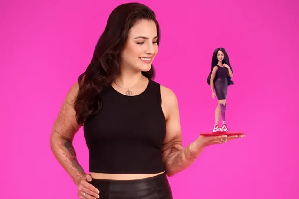 Kelen Ferreira, sobrevivente da Kiss, é inspiração para boneca Barbie
