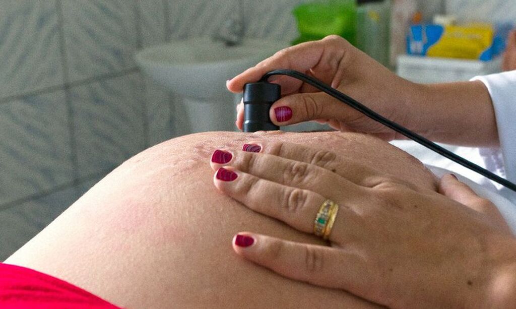 título imagem 300 mil mulheres morrem anualmente em razão de gravidez ou parto, afirma OMS