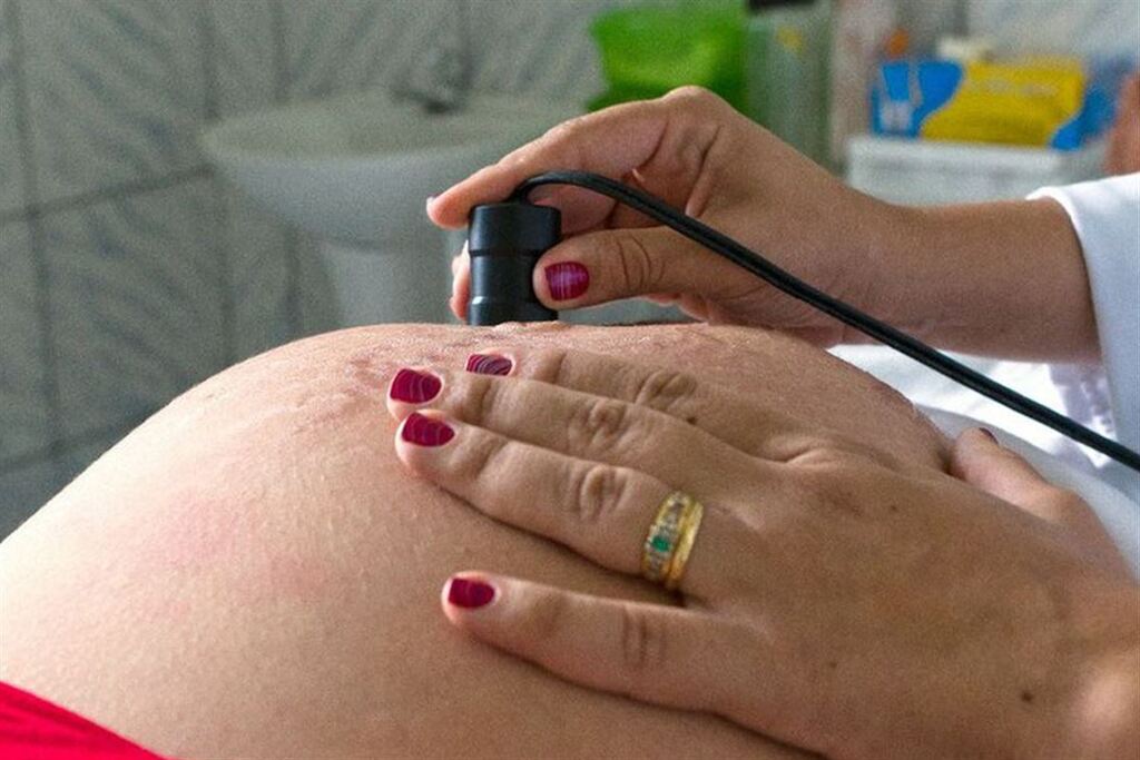 Apesar de evitáveis, mortes maternas por hipertensão persistem no Brasil