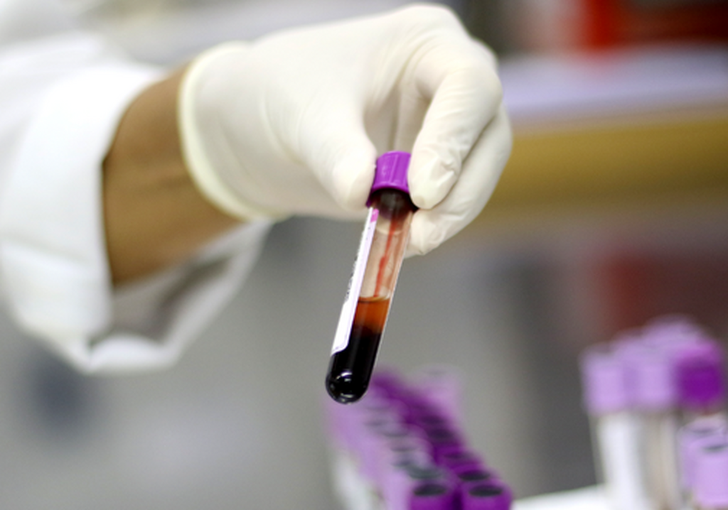 Ministério da Saúde descarta caso de gripe aviária em um trabalhador do Rio Grande do Sul