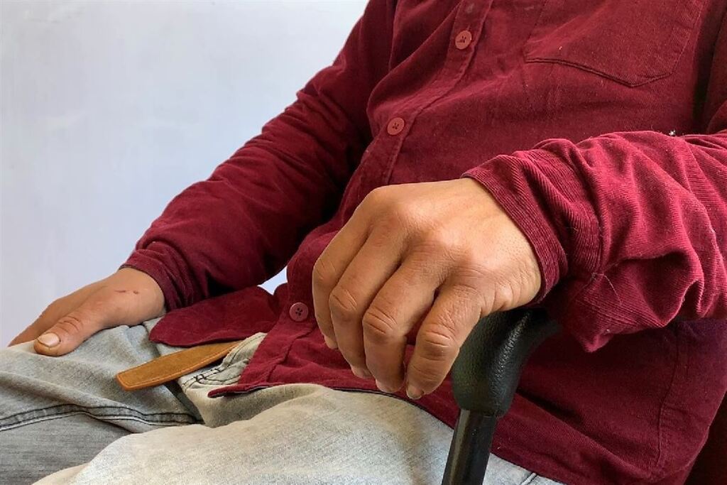 título imagem Homem em situação de rua que foi agredido em Santa Maria diz que não entendeu ataque: “Fui agredido sem motivo nenhum”