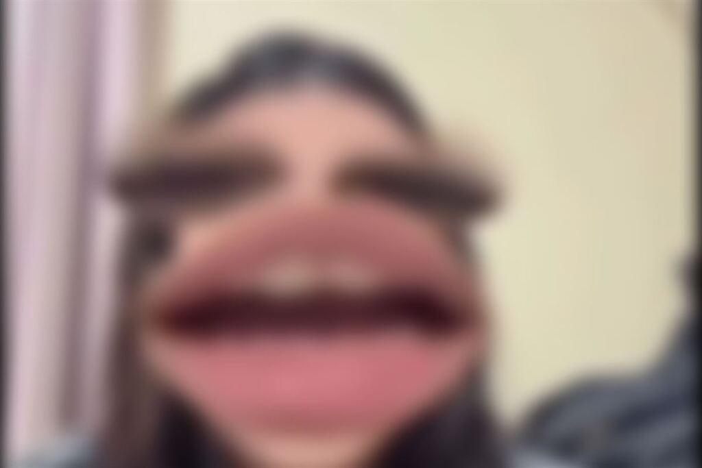 Foto: Redes Sociais (Reprodução) - 