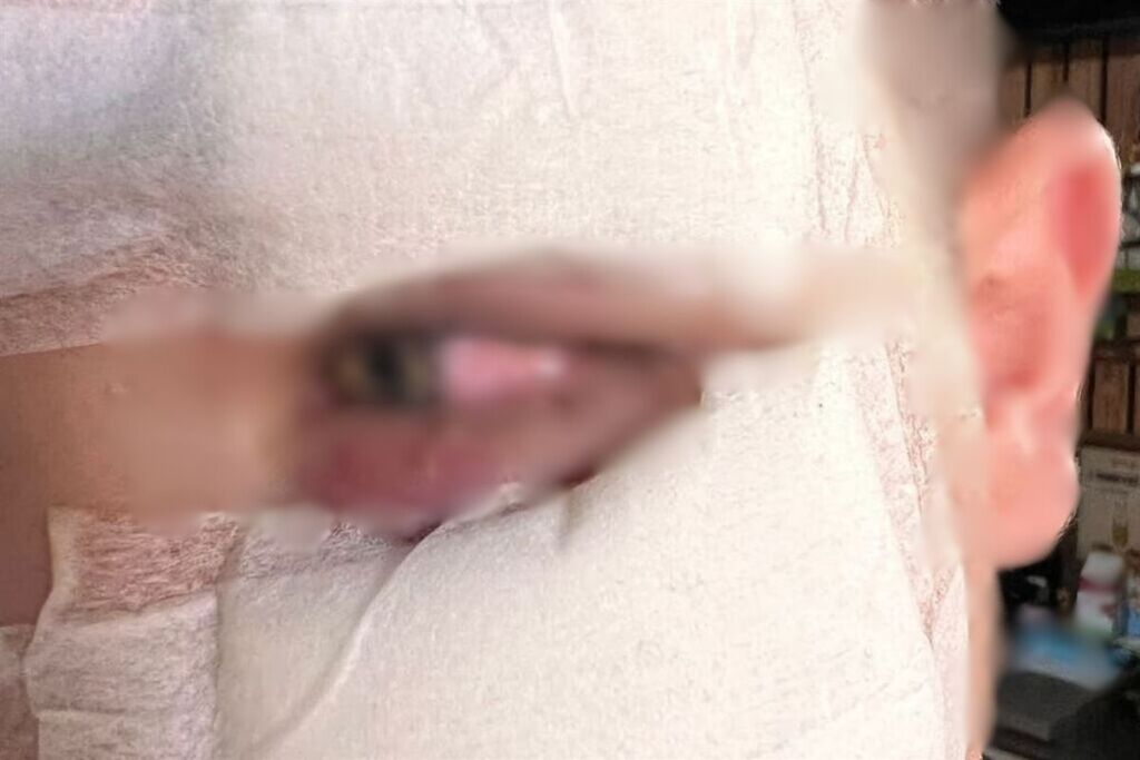 Foto: Arquivo Pessoal - Estudante de 13 anos sofreu ferimentos no rosto e no olho esquerdo