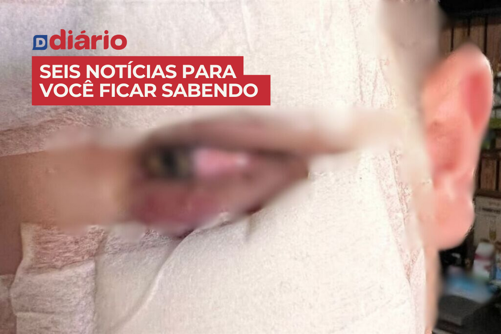Pai diz que filho teria levado tijolada no rosto em escola da região; instituição comunica que está apurando o caso e outras 5 notícias
