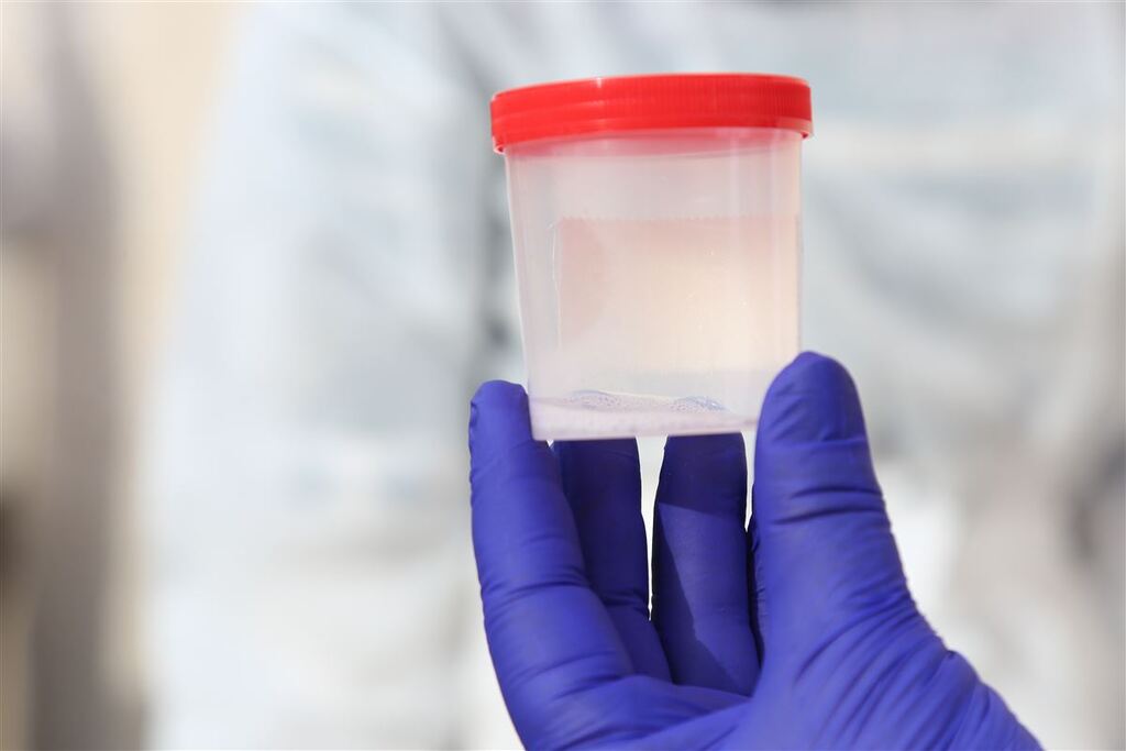 título imagem Aumento de casos de tuberculose entre população privada de liberdade gera alerta no Estado