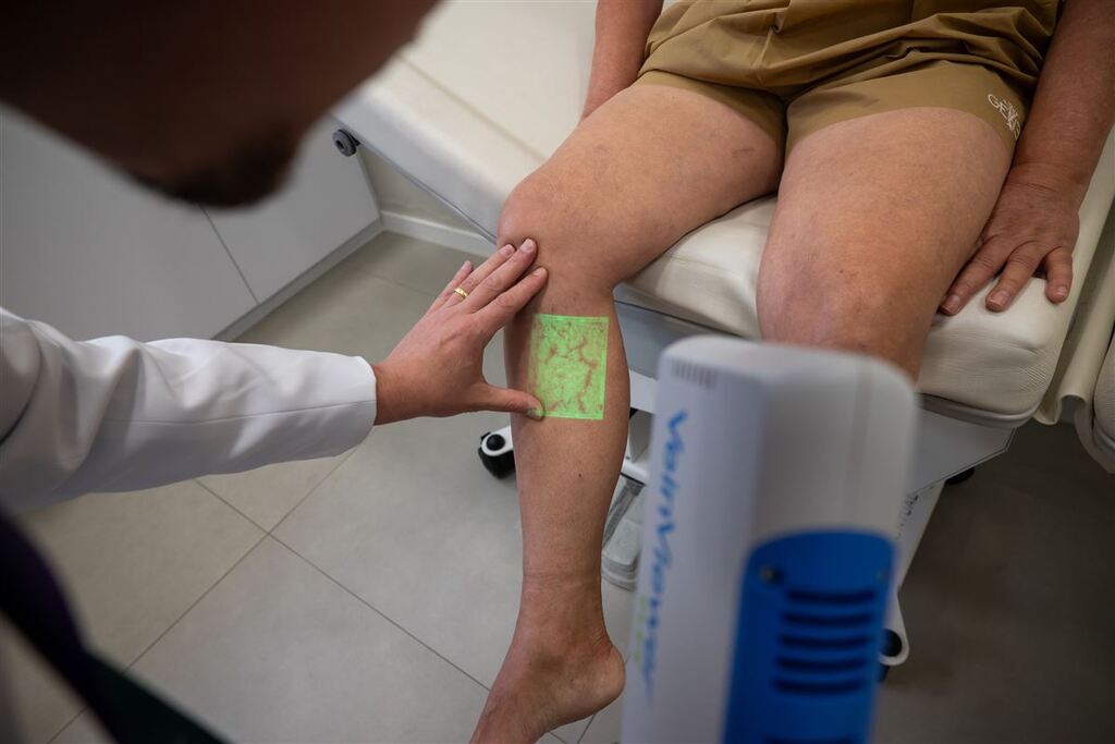 título imagem Brasil registra 200 novos casos de trombose por dia em 2025; veja o que diz especialista