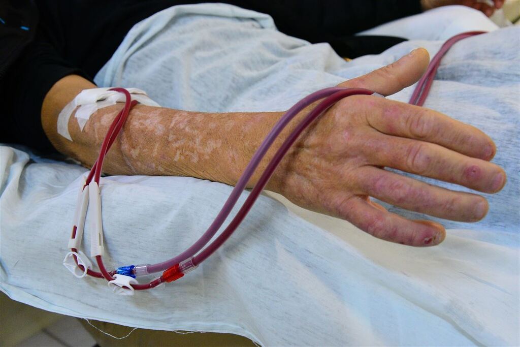 Ministério da Saúde deve aumentar em 15% os repasses para hemodiálises