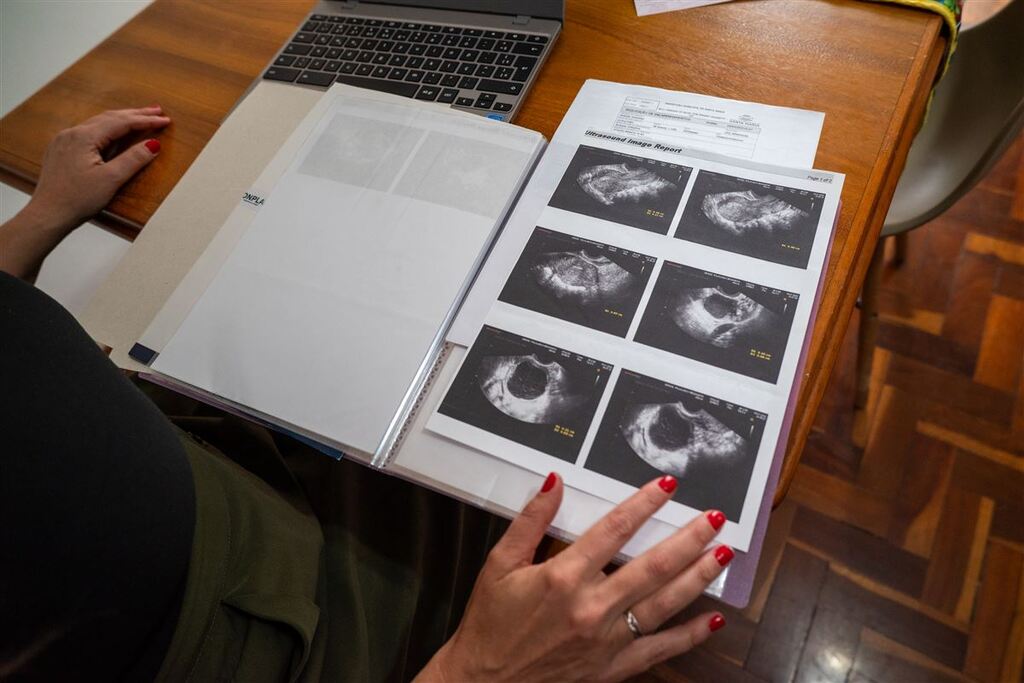 Fotos: Vinícius Becker - 