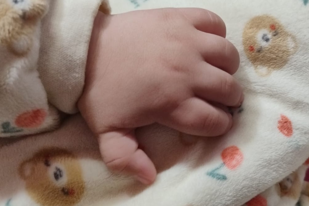 Família busca ajuda para tratar bebê com síndromes raras em Santa Maria