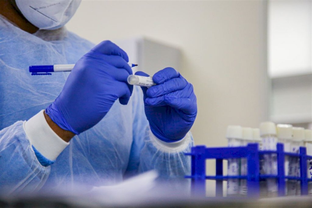 Estado confirma primeiro caso simultâneo de Covid e H3N2 em um mesmo paciente