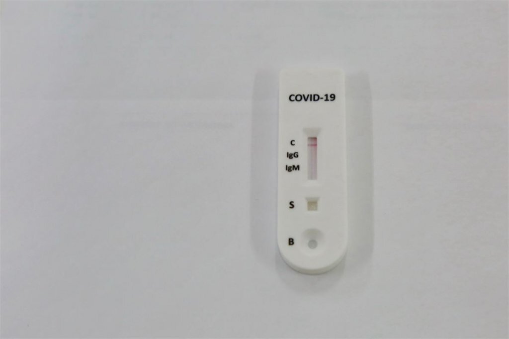 Santa Maria tem 12.716 casos de Covid-19 e 155 óbitos, aponta boletim