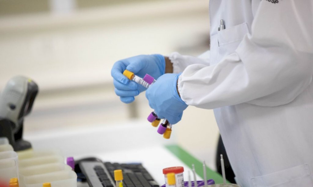 Em uma semana, casos de Covid-19 caem 30% e mortes, 13% no Brasil