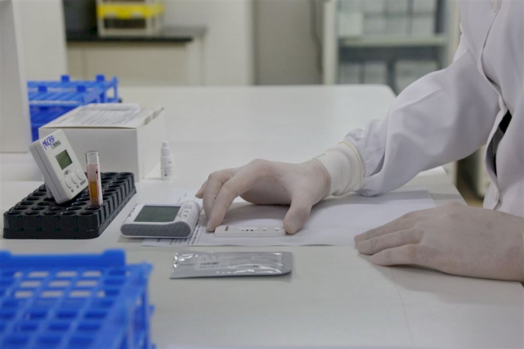 Boletim de Santa Maria registra mais 111 casos confirmados de Covid-19