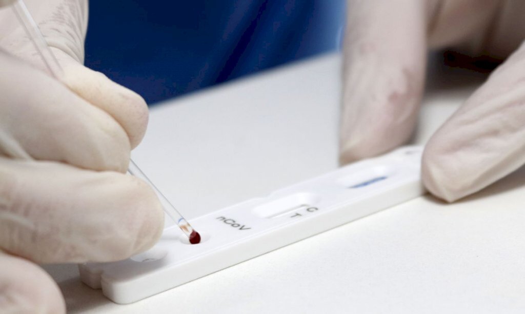 Brasil registra 106.523 mortes e 3,27 milhões de casos