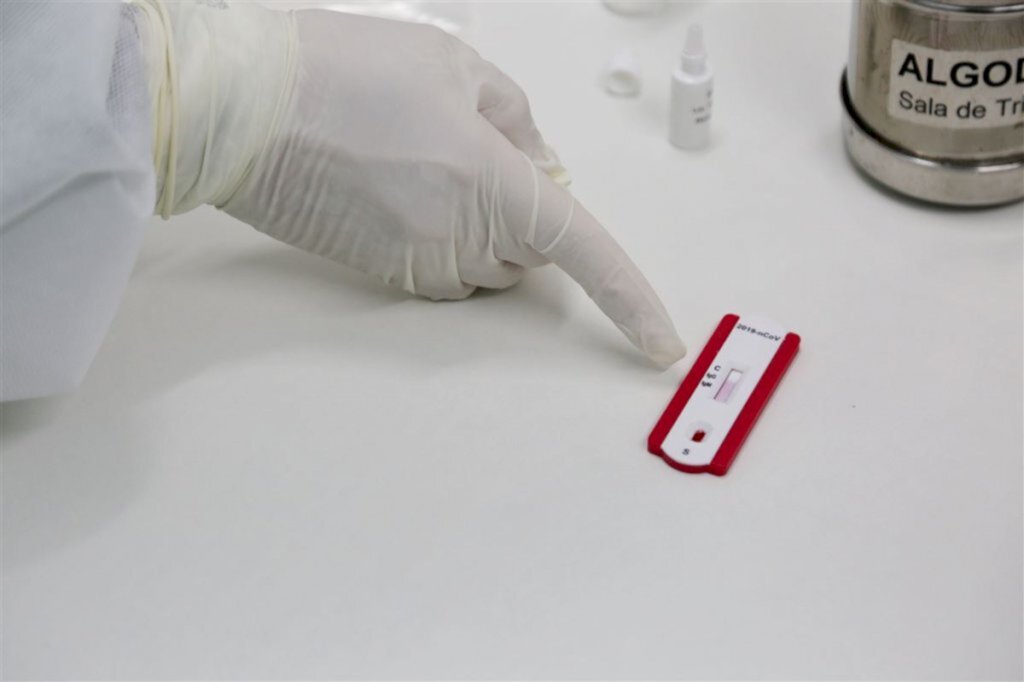 Boletim da prefeitura confirma 1.641 casos de coronavírus em Santa Maria