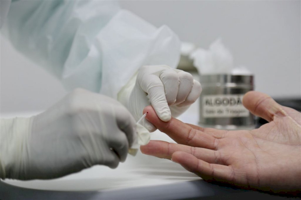 Brasil registra 614 mortes e mais 23.284 casos em 24h