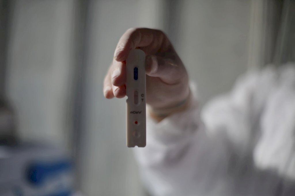 Testagem para o coronavírus deve ter capacidade aumentada no RS