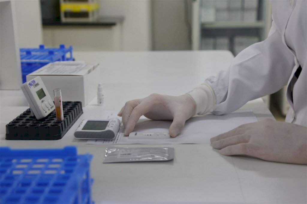 RS tem 6,4 mil casos confirmados de coronavírus e 180 mortes