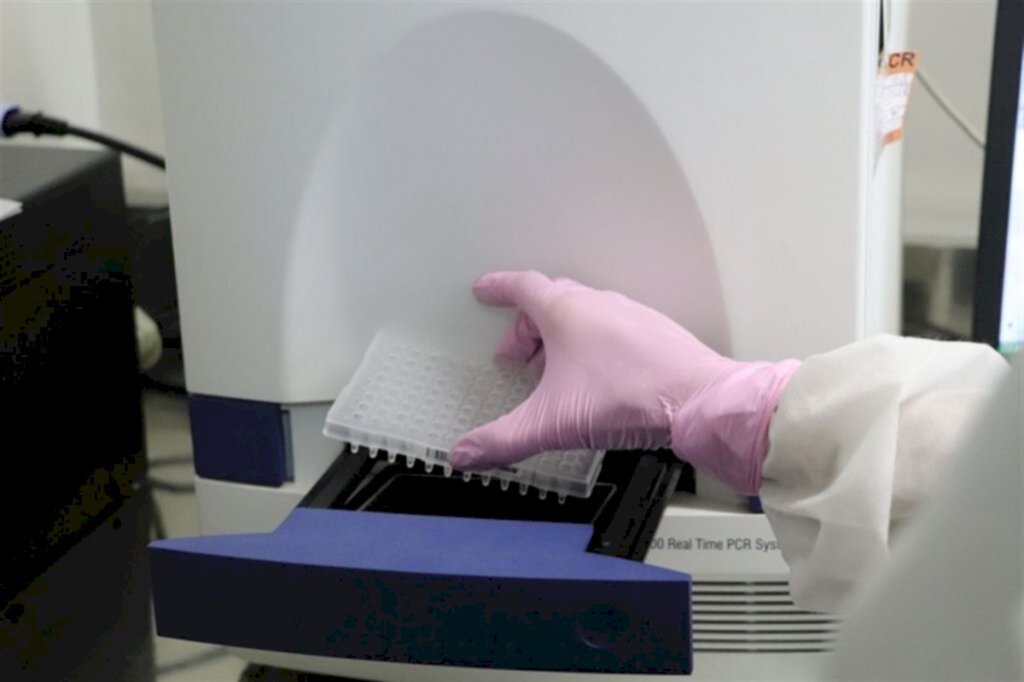 Anvisa aprova três novos testes para diagnóstico do novo coronavírus