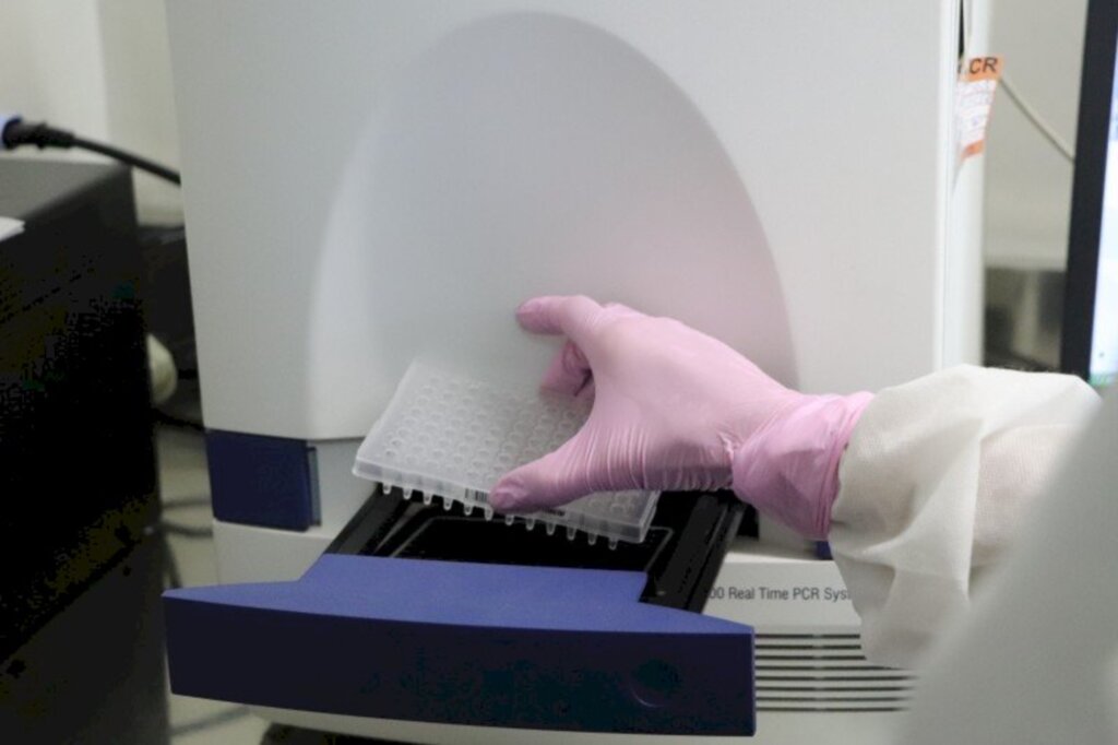 Laboratório do Estado já faz exames que confirmam ou descartam coronavírus