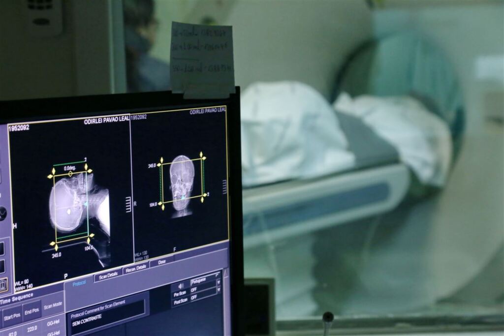 Foto: Charles Guerra (Diário) - Paciente do SUS que sofreu acidente de trânsito perdeu uma grande parte da calota craniana em função do inchaço  do cérebro