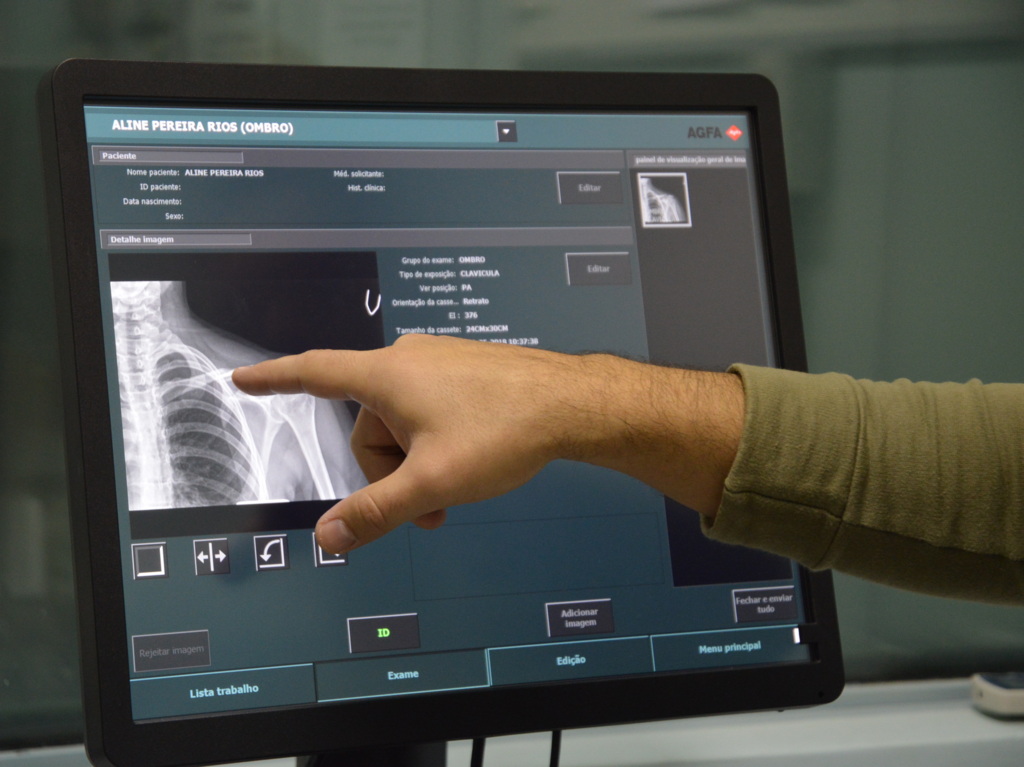 Foto: João Vilnei (Prefeitura de Santa Maria) - 