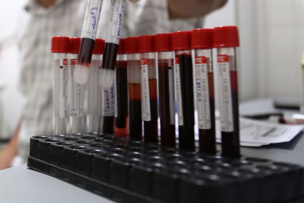 título imagem Exames comprovam que morte de dois fetos e um aborto foram causados pela toxoplasmose