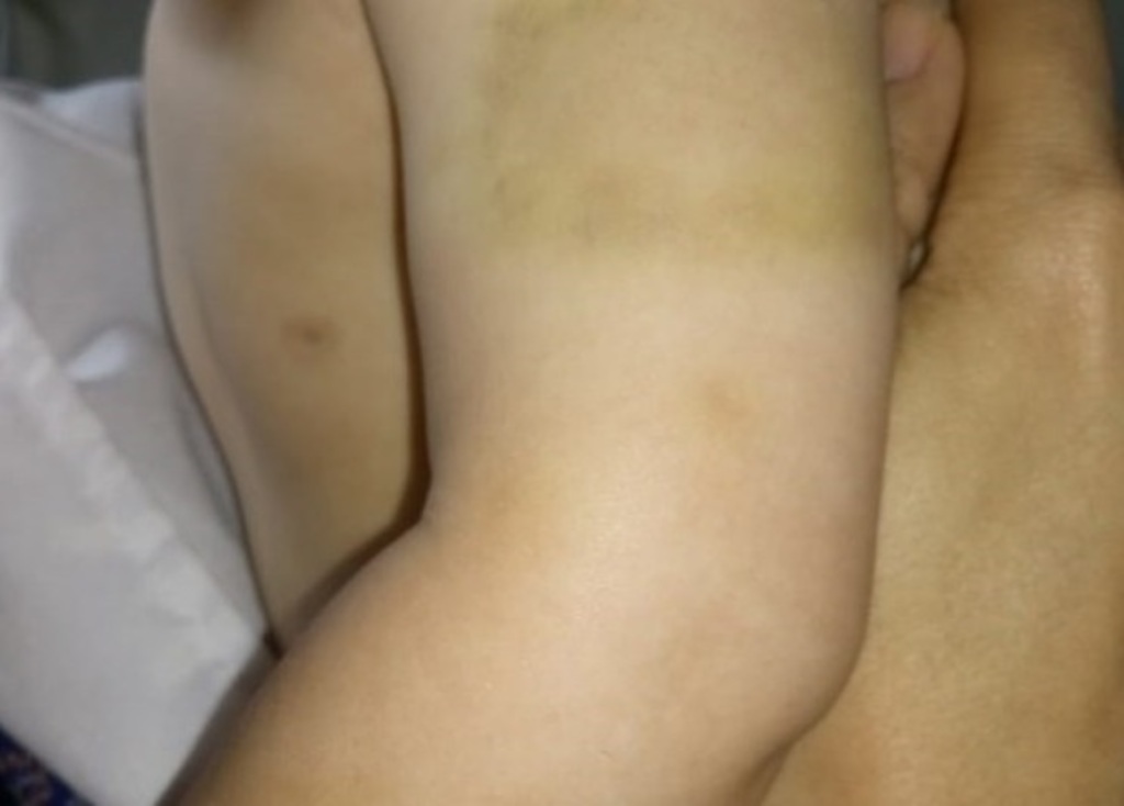 Preso por agredir criança em Rosário do Sul é encontrado morto