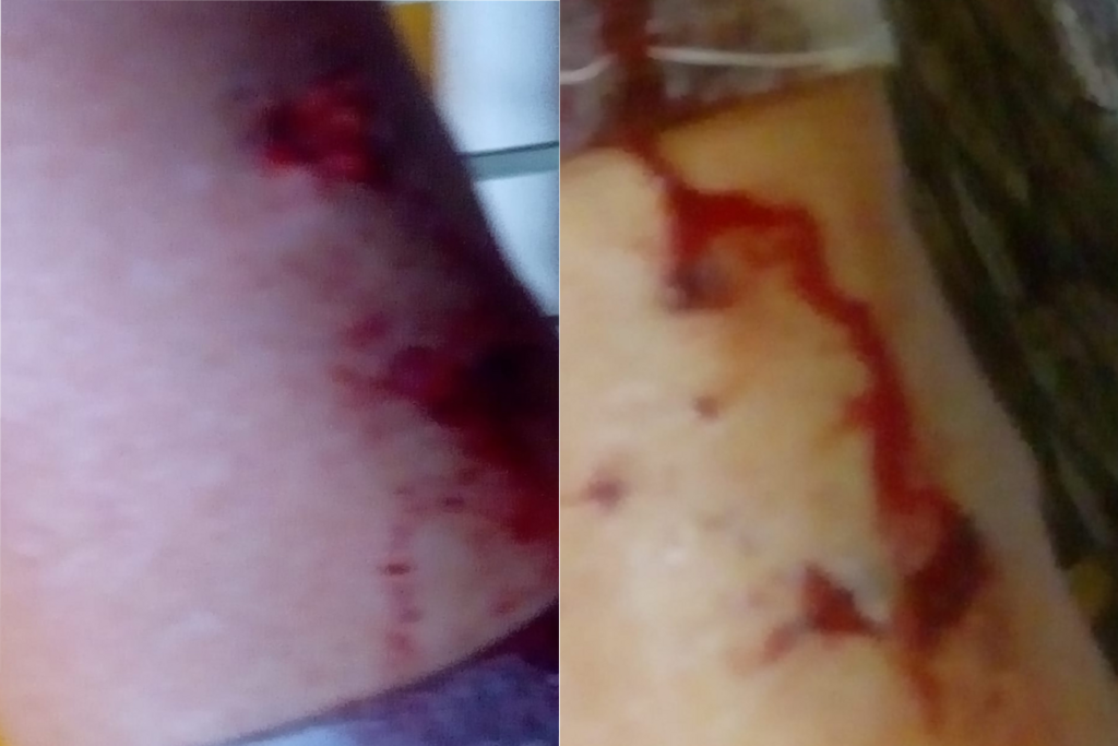 Galeria de imagens: A vítima sofreu mordidas nas pernas, e foi conduzida em estado estável pelo Serviço de Atendimento Móvel de Urgência (Samu) ao Pronto Atendimento (PA) do Bairro Patronato.