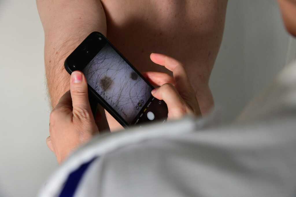 Mais de 95 pessoas são atendidas em ações da campanha Dezembro Laranja no Hospital da Brigada Militar de Santa Maria