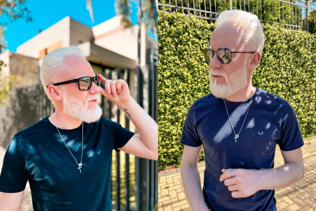 Moda: óculos solares em alta para a próxima estação na coluna de Albino Fashion