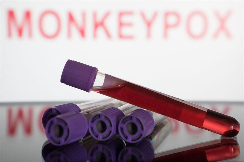 São Paulo registra primeira morte por varíola dos macacos