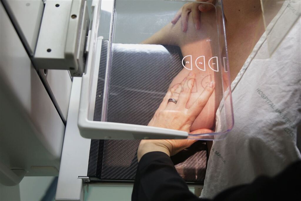 Santa Maria apresenta baixa no índice de exames de mamografia
