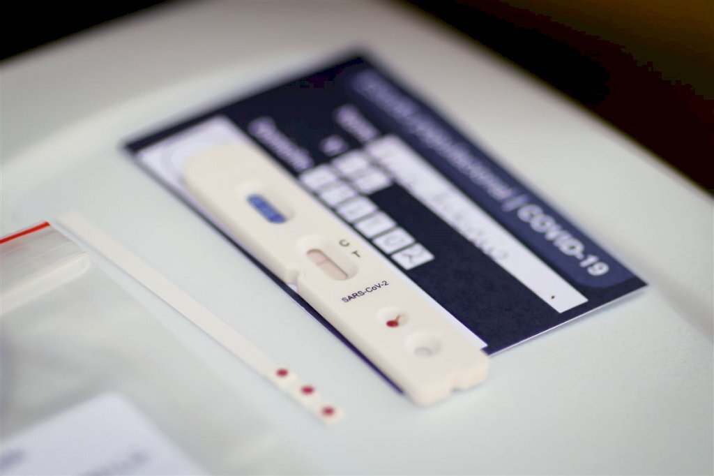 Pesquisa testará presença de anticorpos para Covid-19 em 211 mil pessoas no Brasil