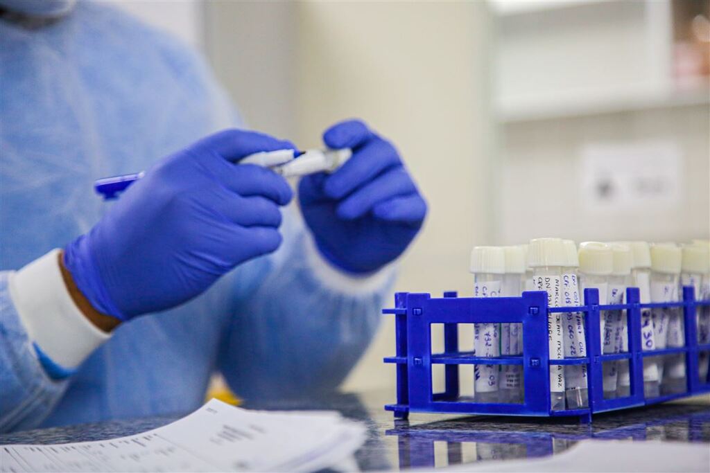 título imagem Santa Maria tem uma drástica redução no número de testes para Covid-19; saiba quais são os impactos