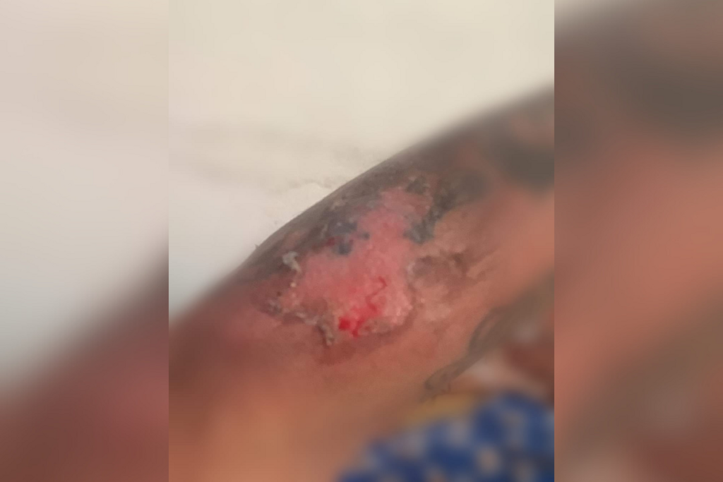 Jovem é queimada com água fervente durante ritual religioso em Santa Maria