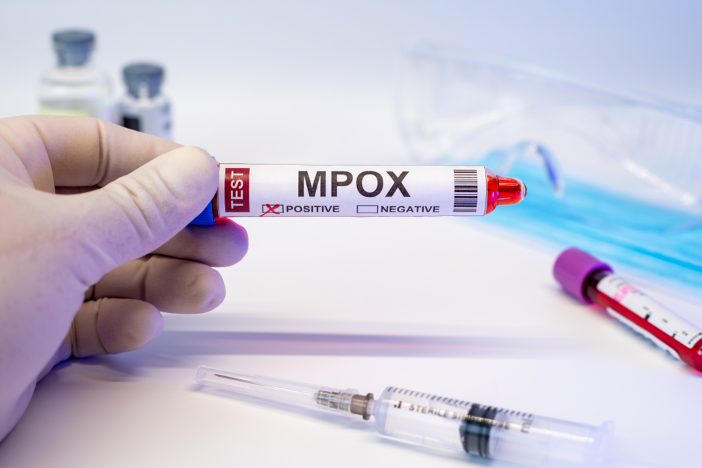  Brasil contabiliza 1,5 mil casos de mpox em 2024