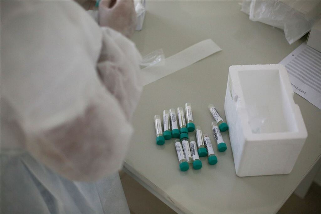 título imagem Estado registra mais de 16 mil hospitalizações por SRAG em 2024; veja o cenário de Santa Maria